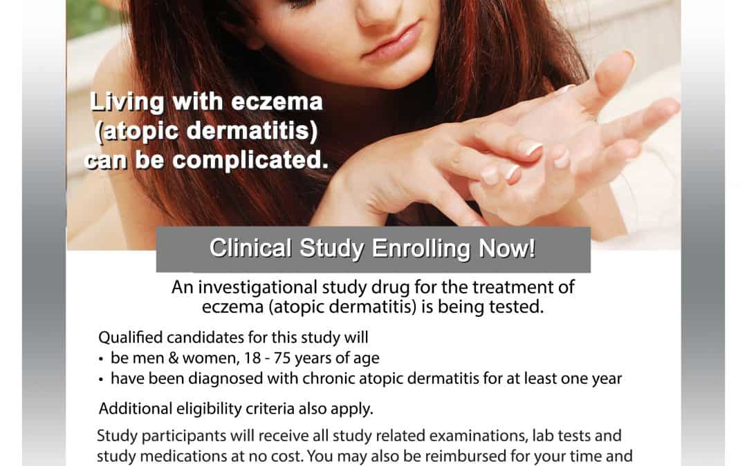 Eczema (Atopic Dermatitis) Clinical Study flyer