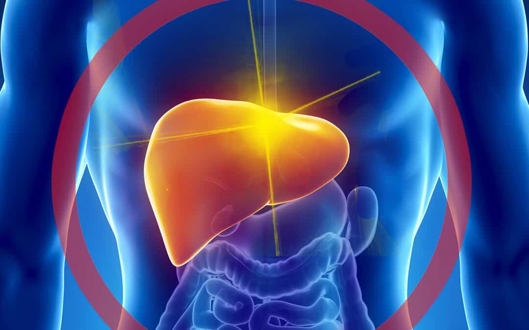 Fatty Liver Disease (NASH) Clinical Trial